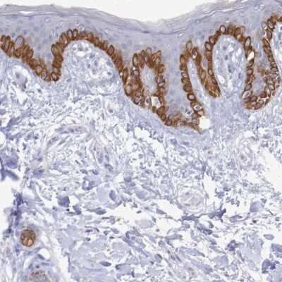 Immunohistochemistry-Paraffin: PLA2G4E Antibody [NBP2-32610]