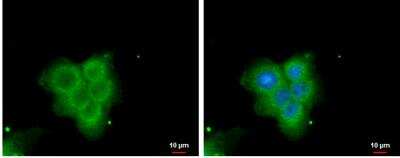 Immunocytochemistry/ Immunofluorescence: PLA2G4F Antibody [NBP2-19855]