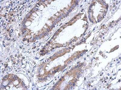 Immunohistochemistry-Paraffin: PLA2G4F Antibody [NBP2-19854]