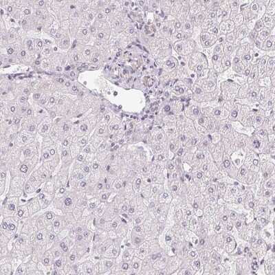 Immunohistochemistry-Paraffin: PLA2G4F Antibody [NBP2-38800]