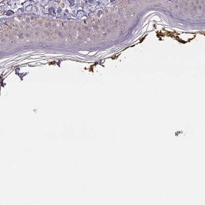 Immunohistochemistry-Paraffin: PLA2G4F Antibody [NBP2-38800]