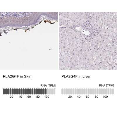 Immunohistochemistry-Paraffin: PLA2G4F Antibody [NBP2-38800]