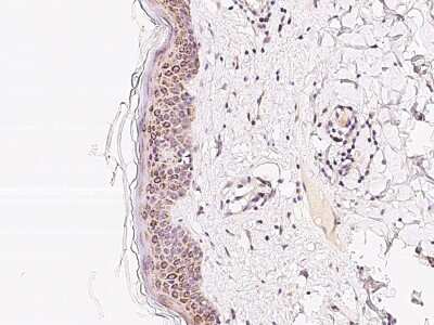 Immunohistochemistry-Paraffin: PLA2G4F Antibody [NBP2-97276]