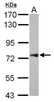 Western Blot: PLA2G4F Antibody [NBP2-19854]