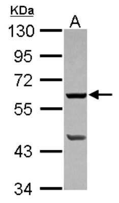 Western Blot: PLA2G4F Antibody [NBP2-19855]