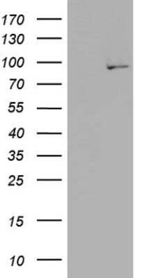 Western Blot: PLA2G6 Antibody (OTI10G4) [NBP2-46431]