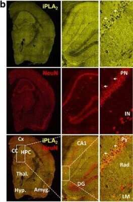 Immunohistochemistry: PLA2G6 Antibody [NBP1-81586]