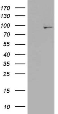 Western Blot: PLA2G6 Antibody (OTI10G4)Azide and BSA Free [NBP2-73456]