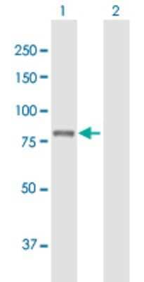 Western Blot: PLA2G6 Antibody [H00008398-B01P]