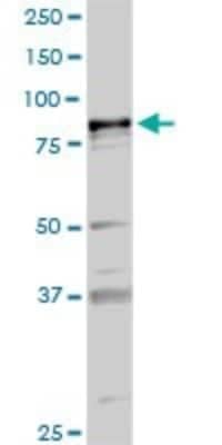 Western Blot: PLA2G6 Antibody [H00008398-D01P]