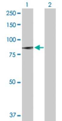 Western Blot: PLA2G6 Antibody [H00008398-D01P]