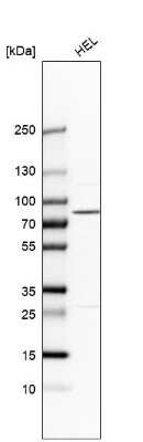 Western Blot: PLA2G6 Antibody [NBP1-81586]