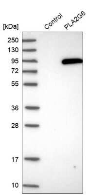 Western Blot: PLA2G6 Antibody [NBP1-81586]