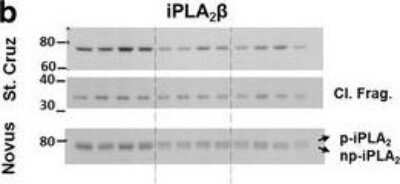 Western Blot: PLA2G6 Antibody [NBP1-81586]