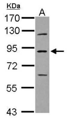 Western Blot: PLA2G6 Antibody [NBP2-19856]