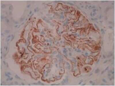 Immunohistochemistry: PLA2R1 Antibody (12-6-5) - Azide and BSA Free [NBP2-80912]