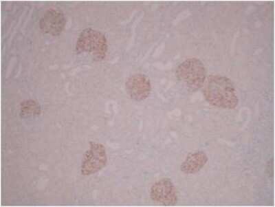 Immunohistochemistry: PLA2R1 Antibody (12-6-5) - BSA Free [NBP2-50248]