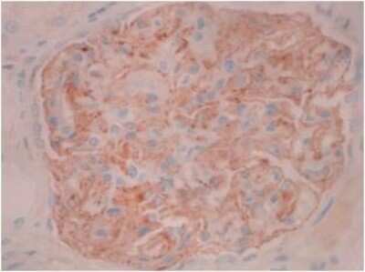 Immunohistochemistry: PLA2R1 Antibody (12-6-5) - BSA Free [NBP2-50248]