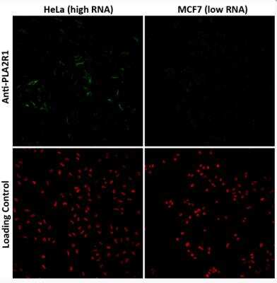 Immunocytochemistry/ Immunofluorescence: PLA2R1 Antibody (CL0474) [NBP2-52933]