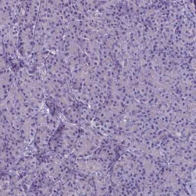 Immunohistochemistry-Paraffin: PLA2R1 Antibody (CL0474) [NBP2-52933]