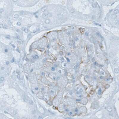 Immunohistochemistry-Paraffin: PLA2R1 Antibody (CL0474) [NBP2-52933]