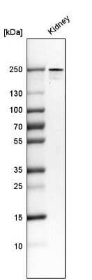 Western Blot: PLA2R1 Antibody (CL0474) [NBP2-52933]