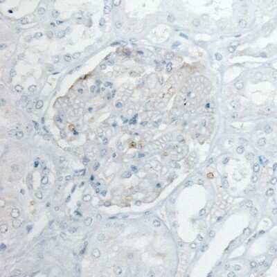 Immunohistochemistry-Paraffin: PLA2R1 Antibody (CL0485) [NBP2-52934]