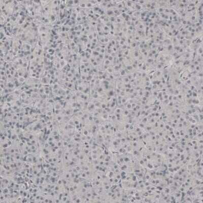 Immunohistochemistry-Paraffin: PLA2R1 Antibody [NBP1-84449]