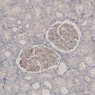Immunohistochemistry-Paraffin: PLA2R1 Antibody [NBP1-84449]