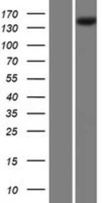 Western Blot: PLA2R1 Overexpression Lysate [NBP2-08815]