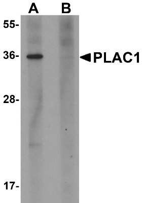 Western Blot: PLAC1 AntibodyBSA Free [NBP1-76485]