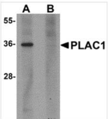 Western Blot: PLAC1 Antibody Blocking Peptide [NBP1-76485PEP]