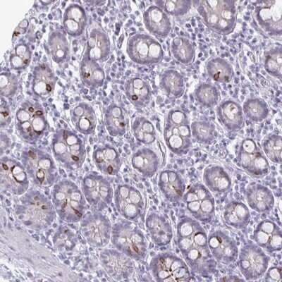 Immunohistochemistry-Paraffin: PLAC1L Antibody [NBP2-33601]