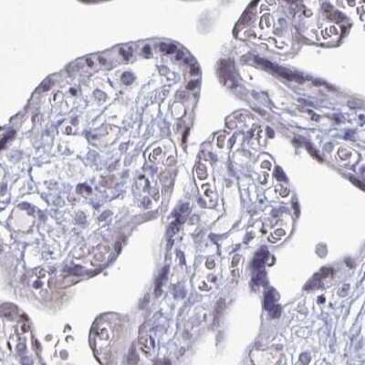 Immunohistochemistry-Paraffin: PLAC1L Antibody [NBP2-33601]