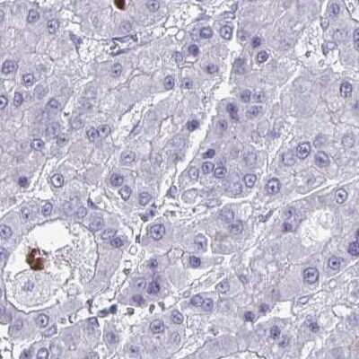 Immunohistochemistry-Paraffin: PLAC1L Antibody [NBP2-33601]