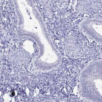 Immunohistochemistry-Paraffin: PLAC1L Antibody [NBP2-33601]