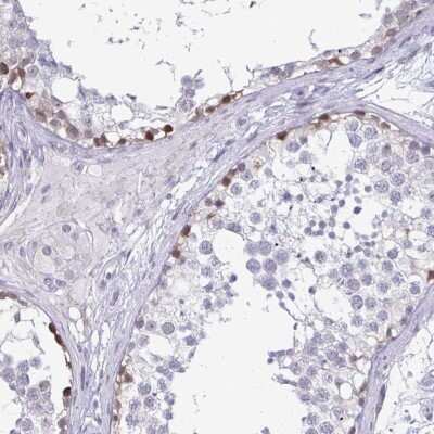 Immunohistochemistry-Paraffin: PLAC1L Antibody [NBP2-33601]