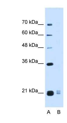 Western Blot: PLAC1L Antibody [NBP1-57983]