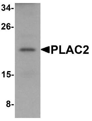 Western Blot: PLAC2 AntibodyBSA Free [NBP1-76486]