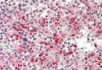 Immunohistochemistry-Paraffin: PLAC8 Antibody [NBP2-85485]