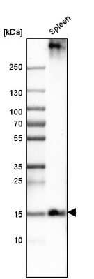 Western Blot: PLAC8 Antibody [NBP1-90721]