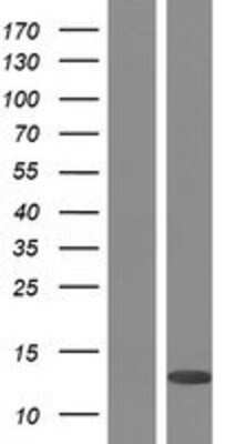 Western Blot: PLAC8 Overexpression Lysate [NBP2-07008]