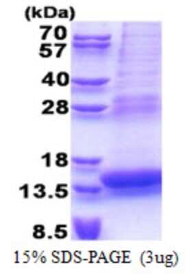 SDS-PAGE: Recombinant Human PLAC8 His Protein [NBP2-23334]