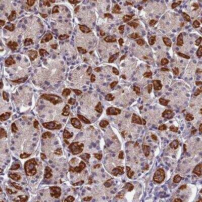 Immunohistochemistry-Paraffin: PLAC9 Antibody [NBP1-86202]