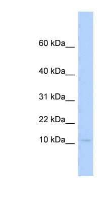 Western Blot: PLAC9 Antibody [NBP1-56571]