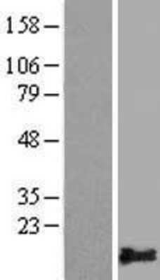 Western Blot: PLAC9 Overexpression Lysate [NBL1-14482]