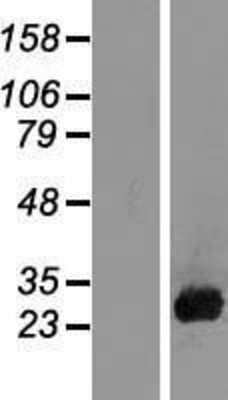 Western Blot: Placental Lactogen/CSH1 Overexpression Lysate [NBL1-09522]