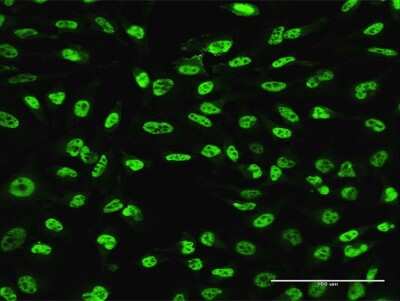 Immunocytochemistry/ Immunofluorescence: PLAG1 Antibody (1F11) [H00005324-M07]