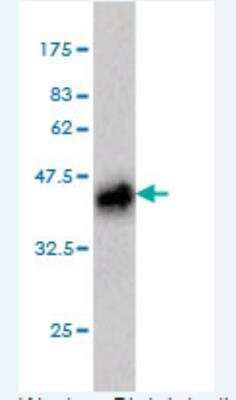 Detection of PLAG1 in Western Blot