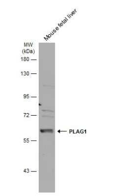 Western Blot: PLAG1 Antibody [NBP2-15075]